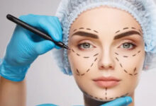 حملات رقابية