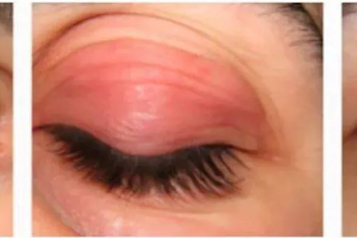 Eyes